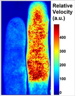 Lasers light up blood-flow dynamics image