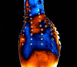 Artery Under Stress image